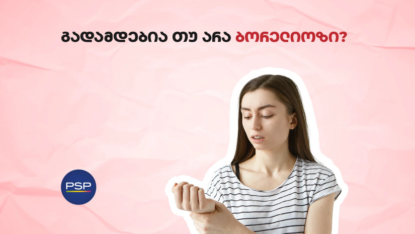 psp psp