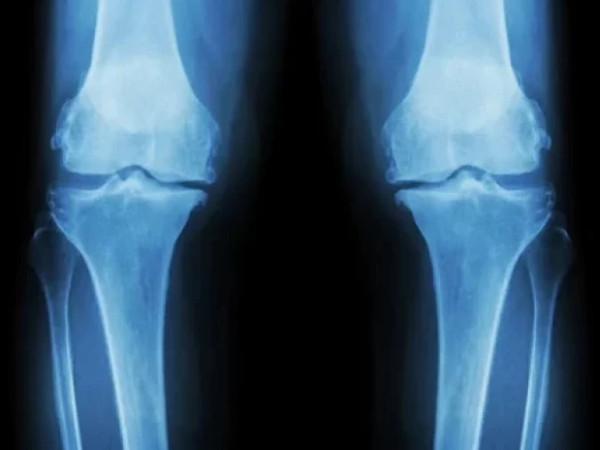 დაზიანებული სახსრები