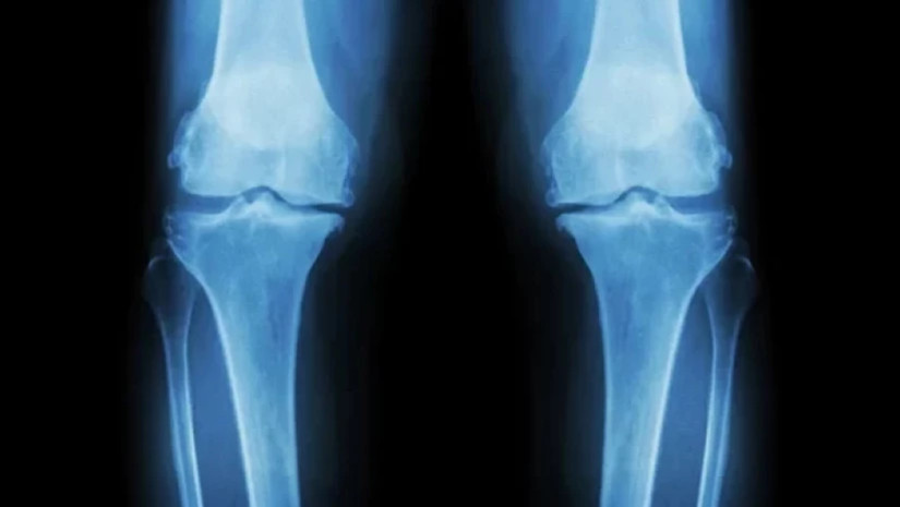 დაზიანებული სახსრები